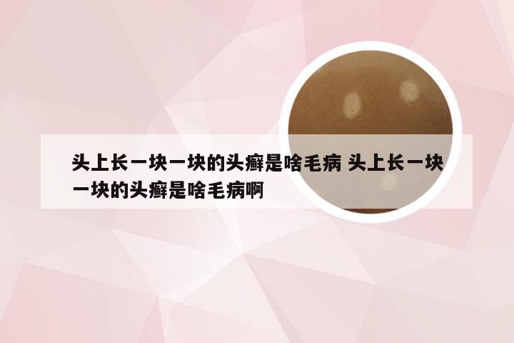 头上长一块一块的头癣是啥毛病 头上长一块一块的头癣是啥毛病啊