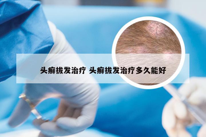 头癣拔发治疗 头癣拔发治疗多久能好