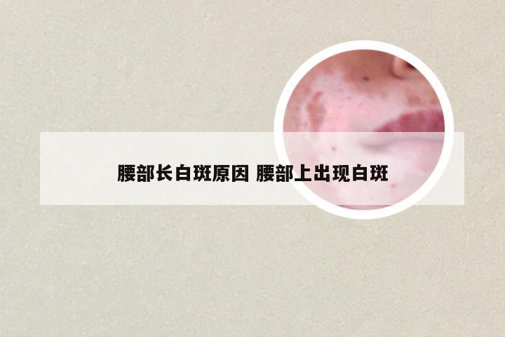 腰部长白斑原因 腰部上出现白斑