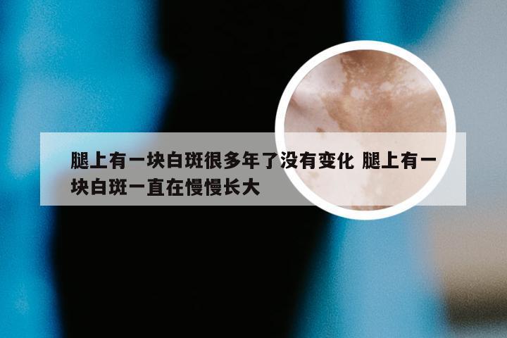 腿上有一块白斑很多年了没有变化 腿上有一块白斑一直在慢慢长大