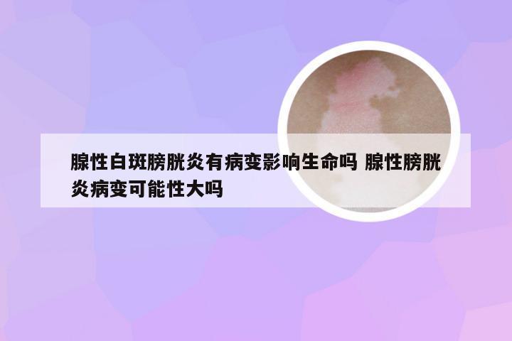 腺性白斑膀胱炎有病变影响生命吗 腺性膀胱炎病变可能性大吗