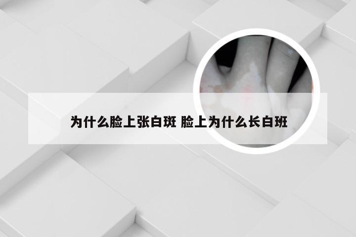 为什么脸上张白斑 脸上为什么长白班