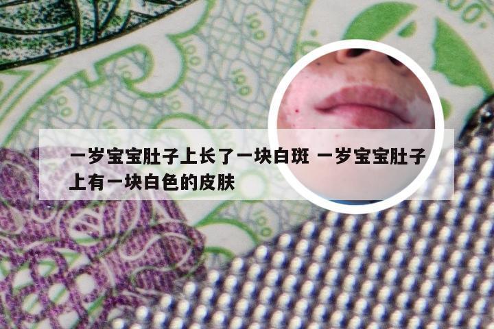 一岁宝宝肚子上长了一块白斑 一岁宝宝肚子上有一块白色的皮肤