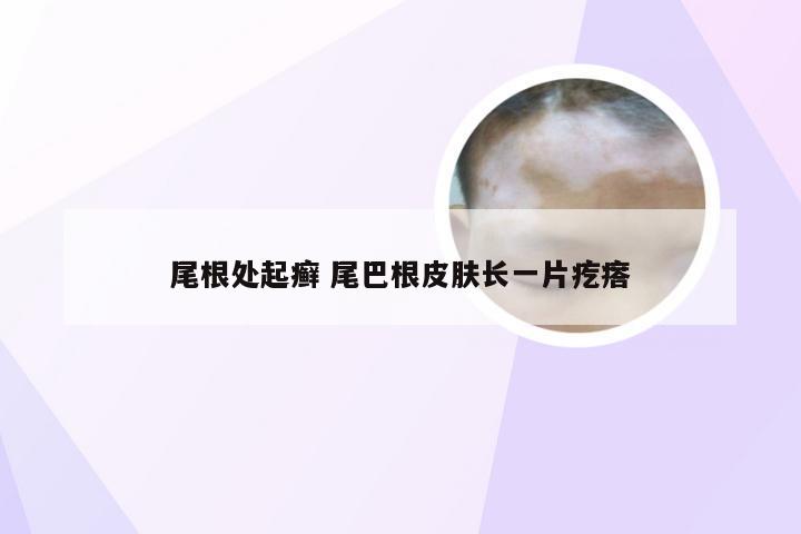 尾根处起癣 尾巴根皮肤长一片疙瘩