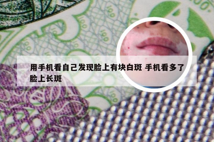 用手机看自己发现脸上有块白斑 手机看多了脸上长斑