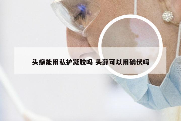 头癣能用私护凝胶吗 头藓可以用碘伏吗