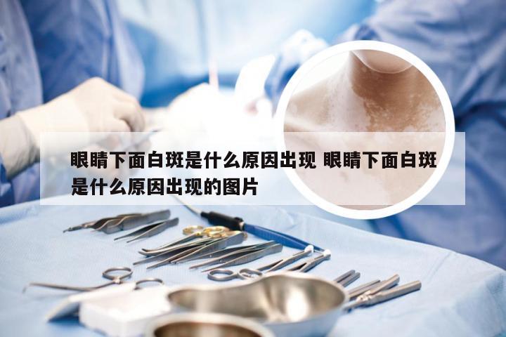 眼睛下面白斑是什么原因出现 眼睛下面白斑是什么原因出现的图片