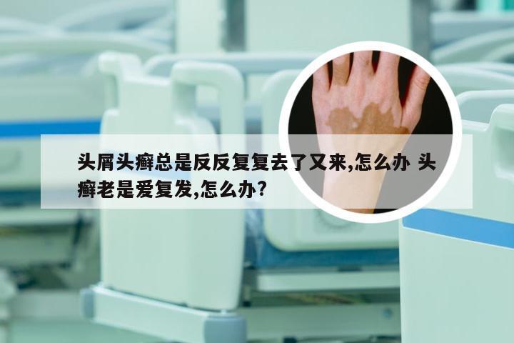 头屑头癣总是反反复复去了又来,怎么办 头癣老是爱复发,怎么办?