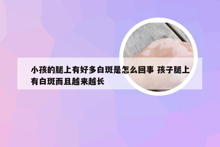 小孩的腿上有好多白斑是怎么回事 孩子腿上有白斑而且越来越长