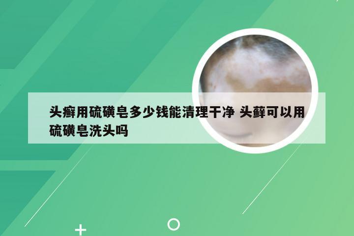 头癣用硫磺皂多少钱能清理干净 头藓可以用硫磺皂洗头吗