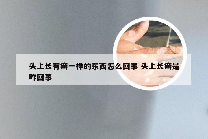 头上长有癣一样的东西怎么回事 头上长癣是咋回事