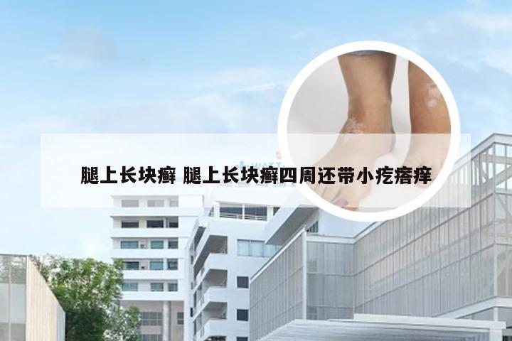 腿上长块癣 腿上长块癣四周还带小疙瘩痒