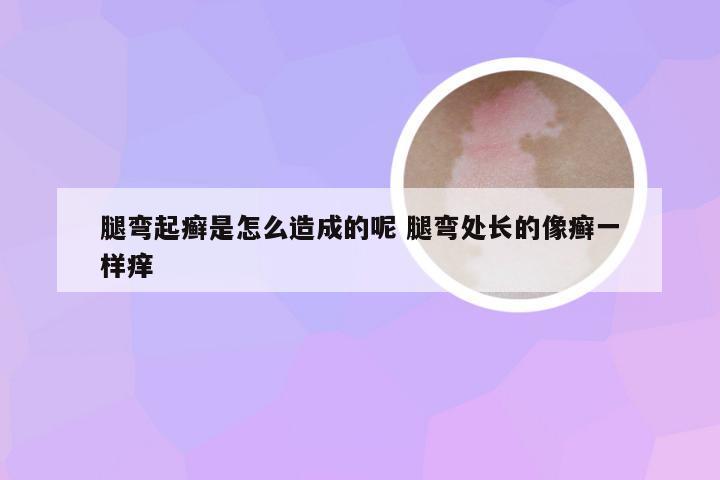 腿弯起癣是怎么造成的呢 腿弯处长的像癣一样痒