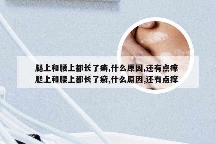 腿上和腰上都长了癣,什么原因,还有点痒 腿上和腰上都长了癣,什么原因,还有点痒