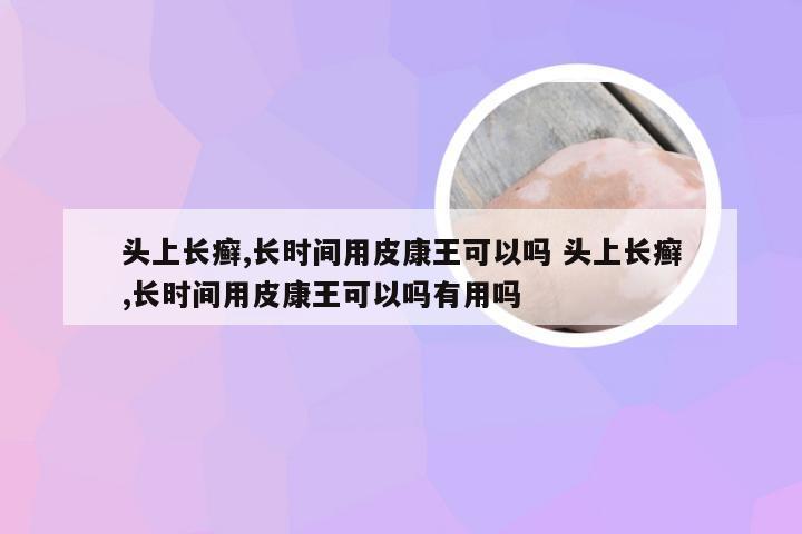 头上长癣,长时间用皮康王可以吗 头上长癣,长时间用皮康王可以吗有用吗