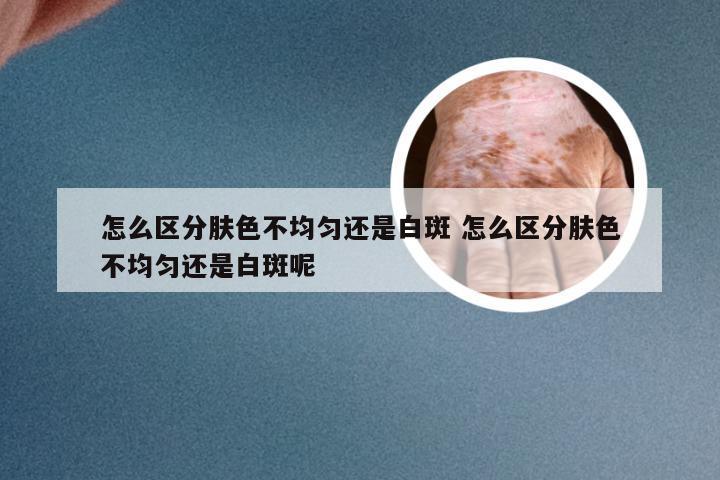 怎么区分肤色不均匀还是白斑 怎么区分肤色不均匀还是白斑呢