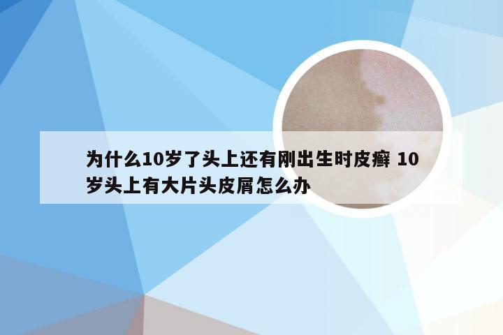 为什么10岁了头上还有刚出生时皮癣 10岁头上有大片头皮屑怎么办