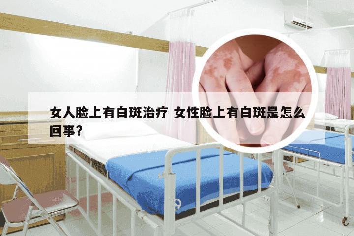 女人脸上有白斑治疗 女性脸上有白斑是怎么回事?