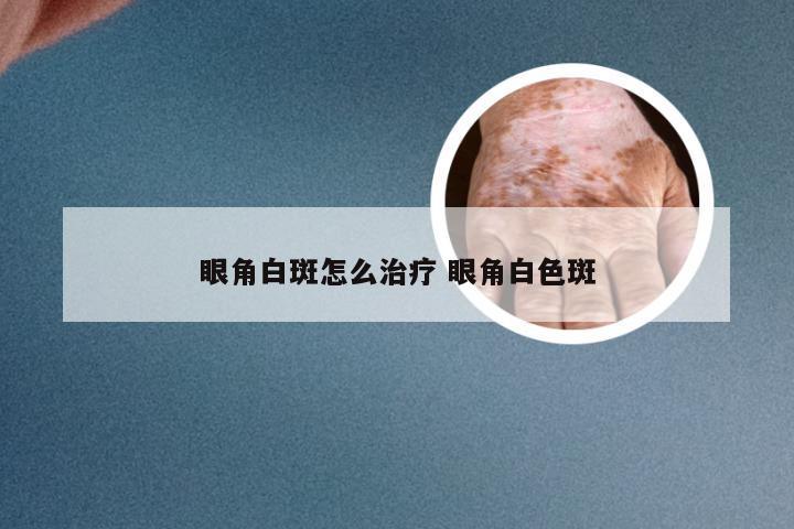 眼角白斑怎么治疗 眼角白色斑