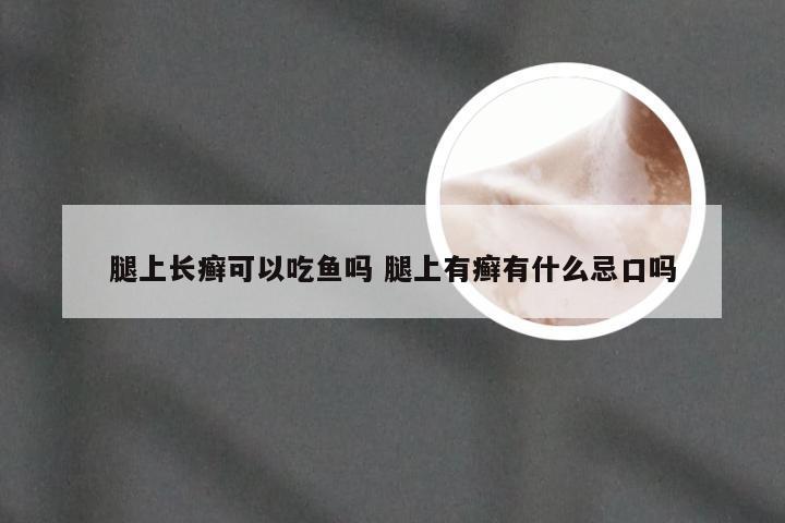 腿上长癣可以吃鱼吗 腿上有癣有什么忌口吗