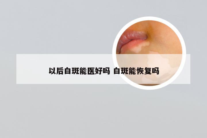 以后白斑能医好吗 白斑能恢复吗