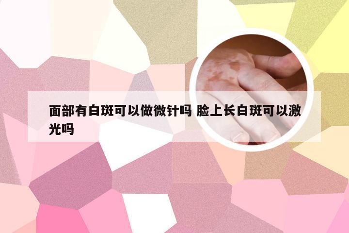 面部有白斑可以做微针吗 脸上长白斑可以激光吗