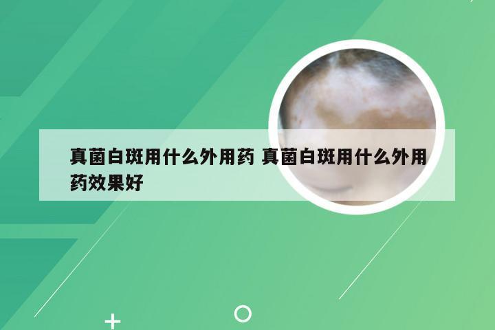 真菌白斑用什么外用药 真菌白斑用什么外用药效果好