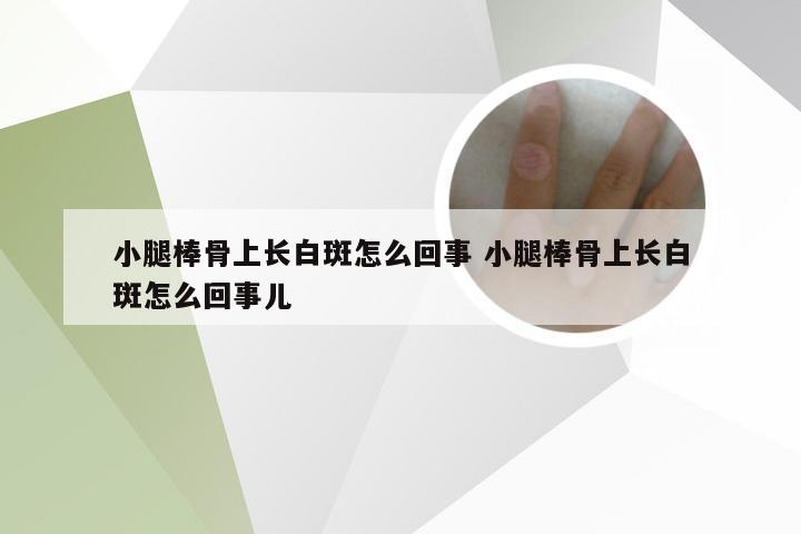 小腿棒骨上长白斑怎么回事 小腿棒骨上长白斑怎么回事儿