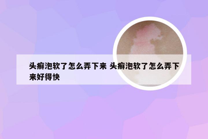 头癣泡软了怎么弄下来 头癣泡软了怎么弄下来好得快