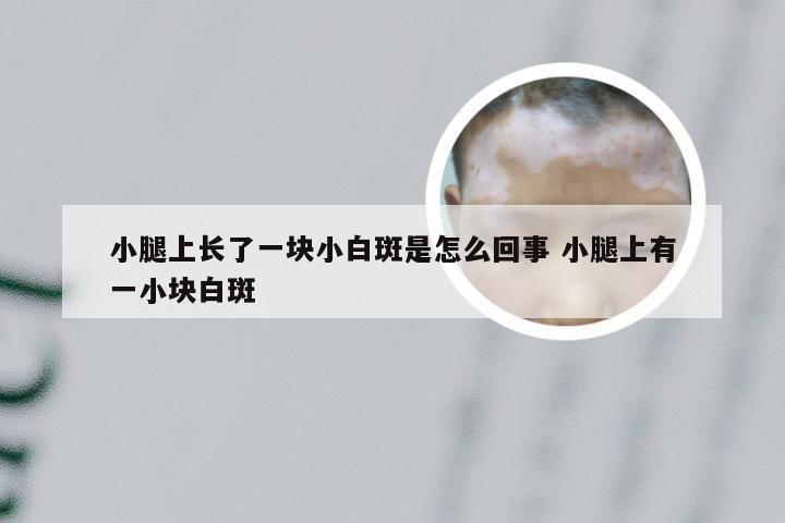 小腿上长了一块小白斑是怎么回事 小腿上有一小块白斑