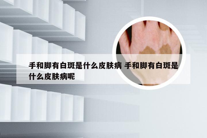 手和脚有白斑是什么皮肤病 手和脚有白斑是什么皮肤病呢