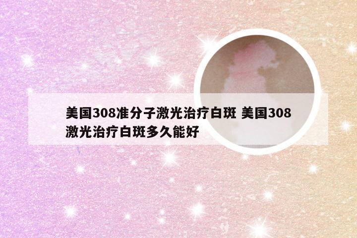 美国308准分子激光治疗白斑 美国308激光治疗白斑多久能好