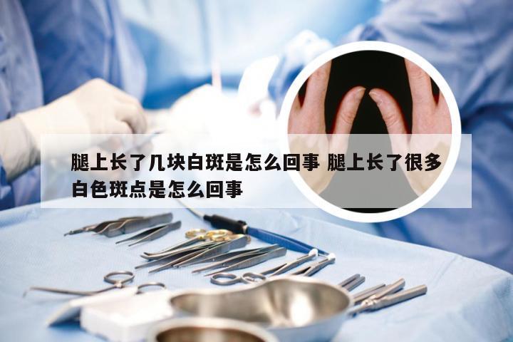 腿上长了几块白斑是怎么回事 腿上长了很多白色斑点是怎么回事