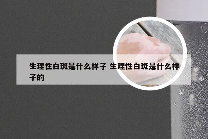 生理性白斑是什么样子 生理性白斑是什么样子的