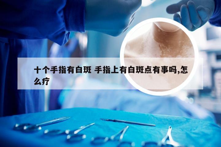 十个手指有白斑 手指上有白斑点有事吗,怎么疗