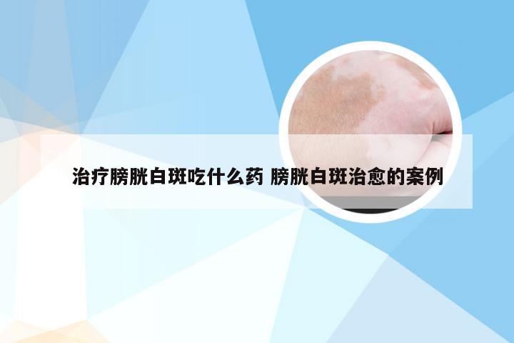 治疗膀胱白斑吃什么药 膀胱白斑治愈的案例