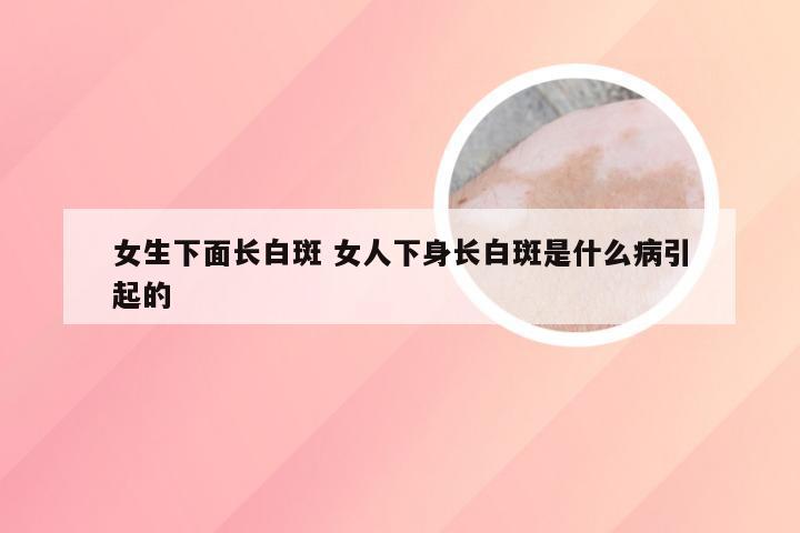 女生下面长白斑 女人下身长白斑是什么病引起的