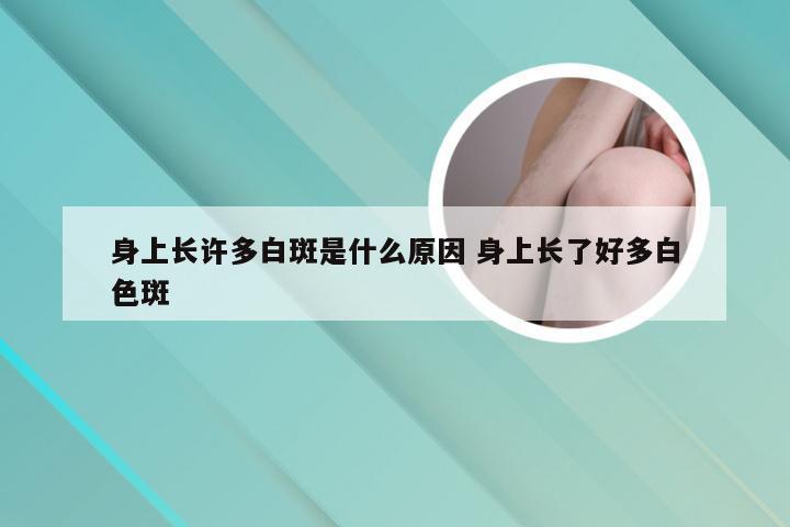 身上长许多白斑是什么原因 身上长了好多白色斑