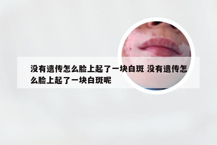 没有遗传怎么脸上起了一块白斑 没有遗传怎么脸上起了一块白斑呢