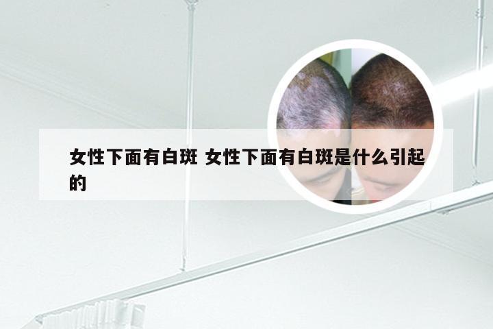 女性下面有白斑 女性下面有白斑是什么引起的