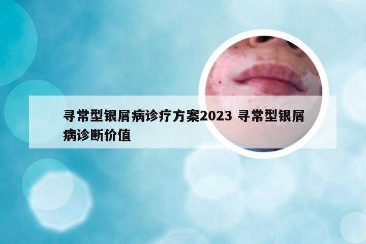 寻常型银屑病诊疗方案2023 寻常型银屑病诊断价值