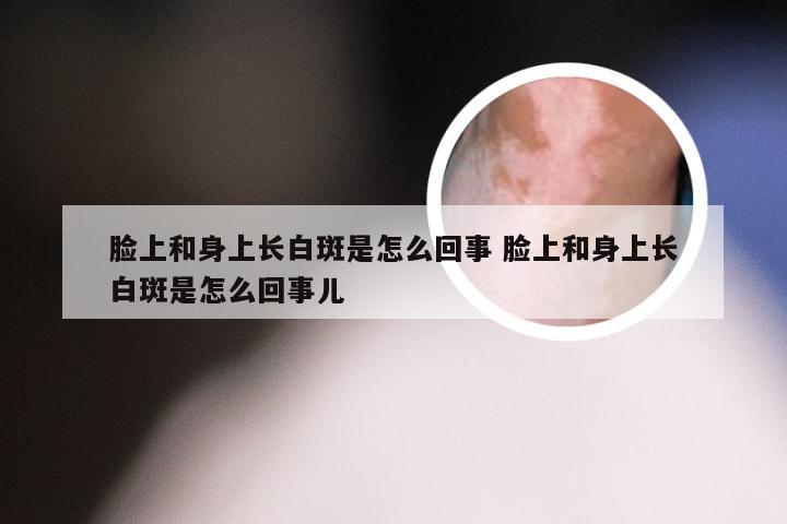 脸上和身上长白斑是怎么回事 脸上和身上长白斑是怎么回事儿