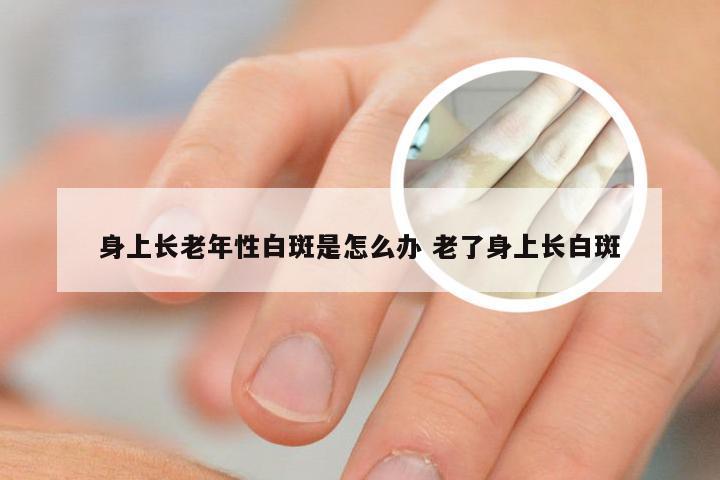 身上长老年性白斑是怎么办 老了身上长白斑