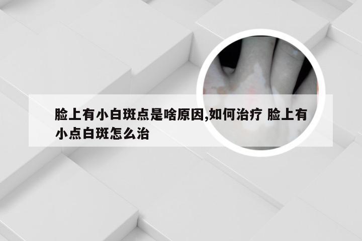 脸上有小白斑点是啥原因,如何治疗 脸上有小点白斑怎么治