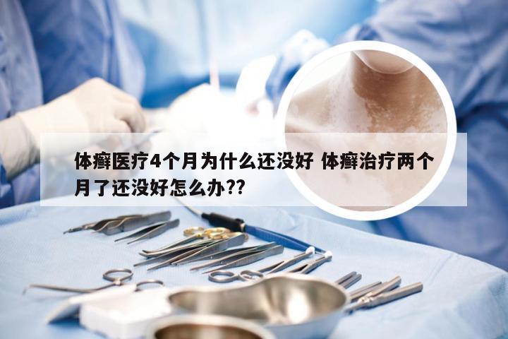 体癣医疗4个月为什么还没好 体癣治疗两个月了还没好怎么办??