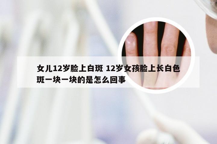 女儿12岁脸上白斑 12岁女孩脸上长白色斑一块一块的是怎么回事