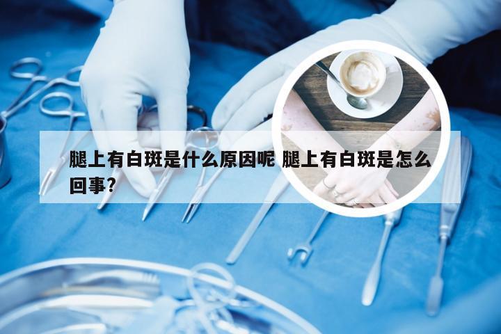 腿上有白斑是什么原因呢 腿上有白斑是怎么回事?