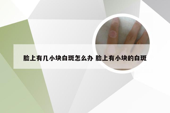 脸上有几小块白斑怎么办 脸上有小块的白斑