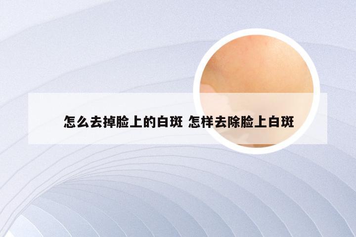 怎么去掉脸上的白斑 怎样去除脸上白斑