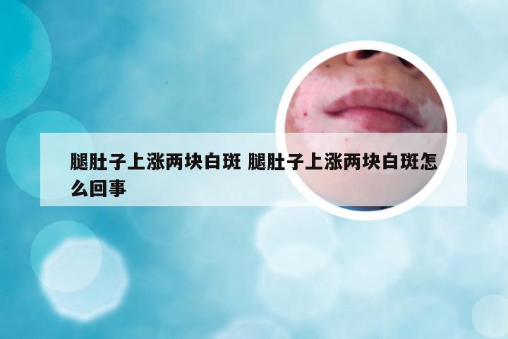 腿肚子上涨两块白斑 腿肚子上涨两块白斑怎么回事